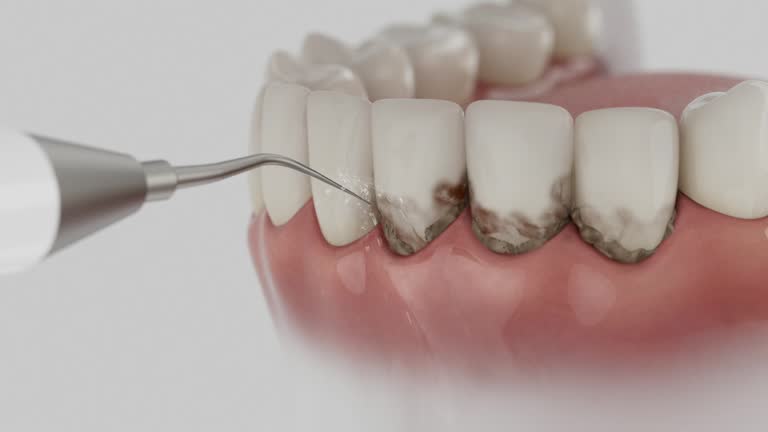 Trusted Root Canal Treatment service in Upper Saddle River, NJ - Dentist Open Now